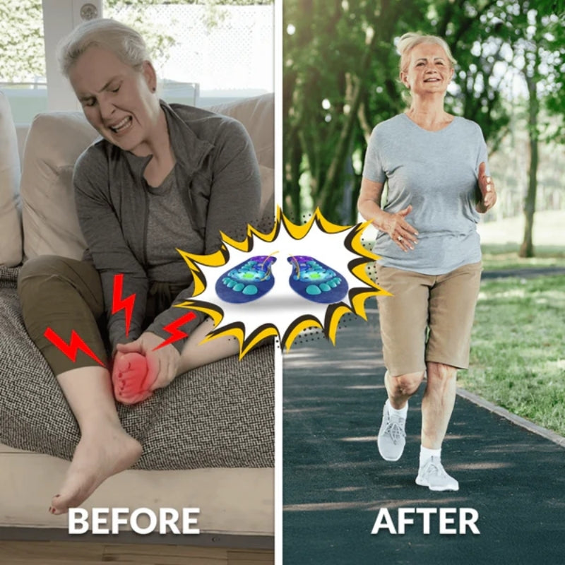 FORGE™ Magnetic Acupressure Insoles for Instant Relief